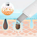 Peeling Ultrassônico Limpador Facial Anti-Rugas  Ionização -Portátil - Recarregável