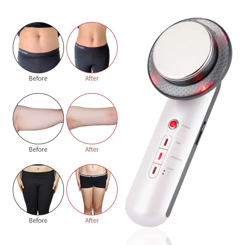 Massageador Ultrassônico Lifting Facial  - Infravermelho Corporal - Redutor de Medidas e Antirrugas